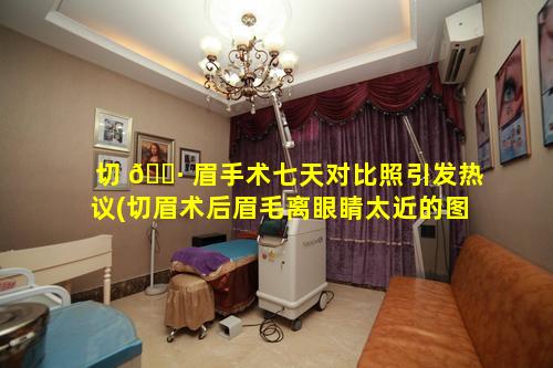 切 🕷 眉手术七天对比照引发热议(切眉术后眉毛离眼睛太近的图片)